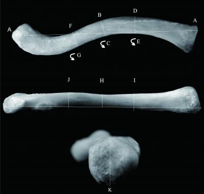 Measurements of clavicle. A: Measurements on maximum length (MXL); B: Anterior-posterior diameter at mid-diaphysis (F); C: Mid-diaphysis circumference (MDC); D:Anterior-posterior diameter at medial 1/3 of clavicle (APM); E: Medial 1/3 clavicular circumference (MC); F: Anterior-posterior diameter at lateral 1/3 of clavicle (APL); G: Lateral 1/3 clavicular circumference (LC); H: Superior-inferior diameter at mid-diaphysis (SIMD); I: Superior-inferior diameter at medial 1/3 of clavicle (SIM); J: Su